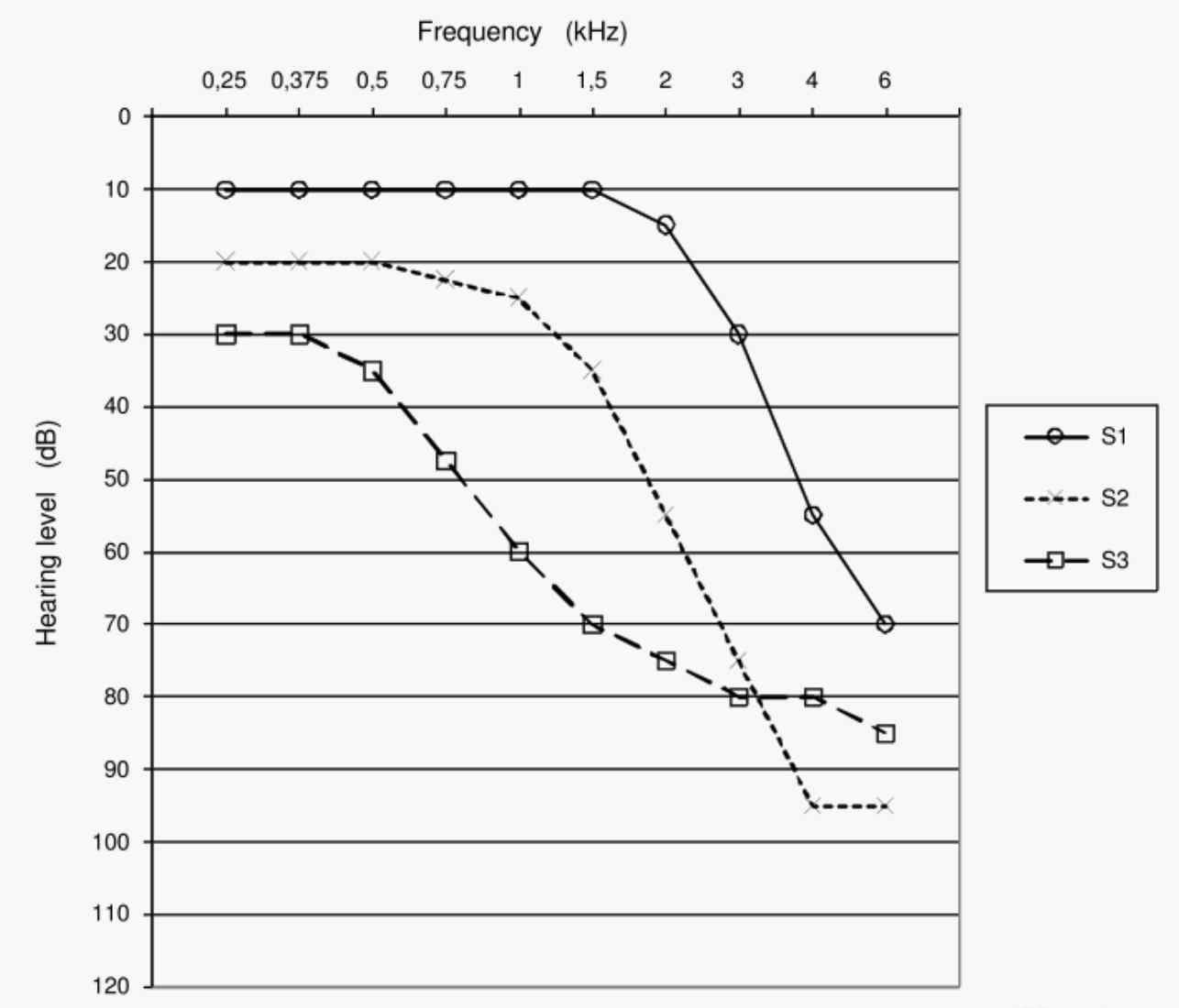 青岛助听器 青岛助听器