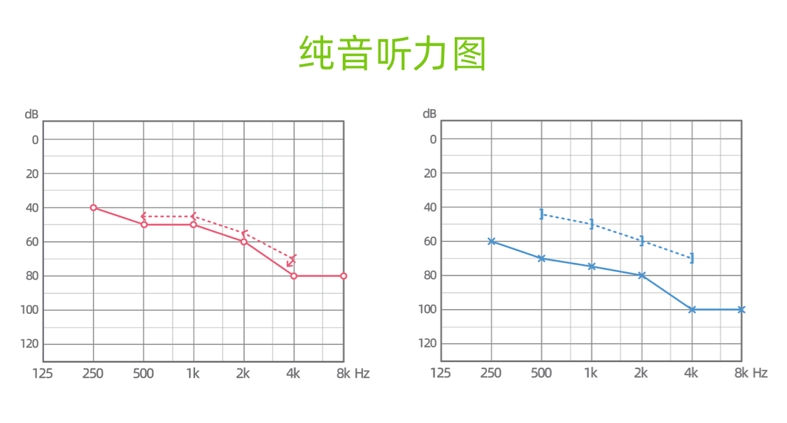 青岛助听器 青岛助听器